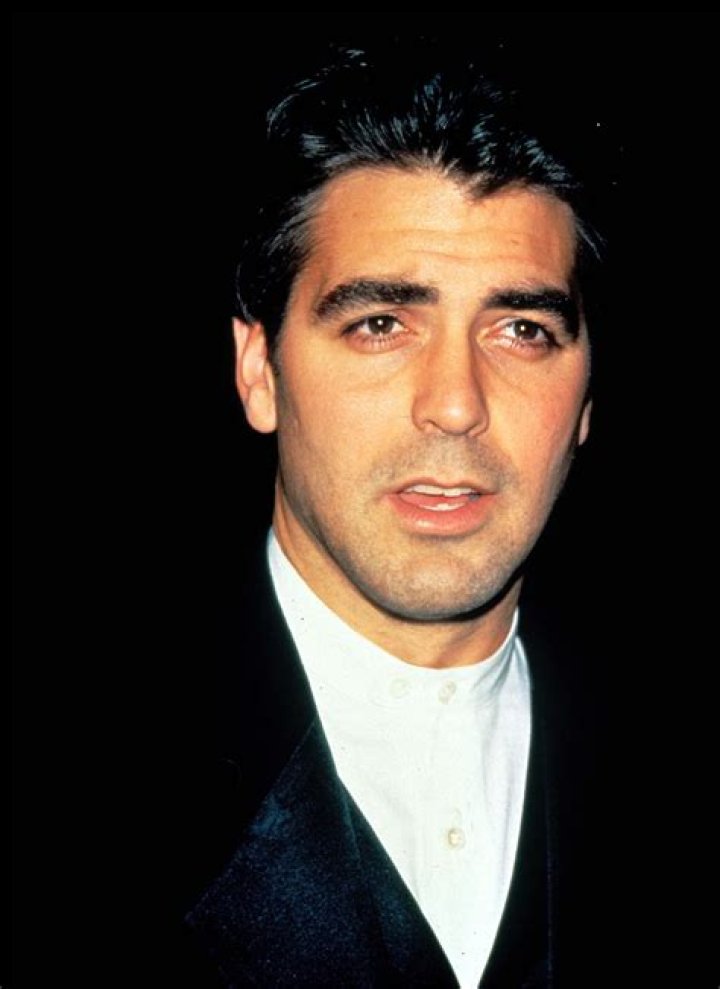 Clooney's Bell's Palsy MedPage Today