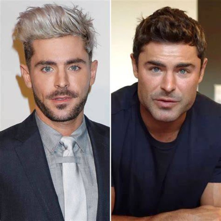 Did Zac Efron Get A Plastic Surgery For His Jaw Before After Look