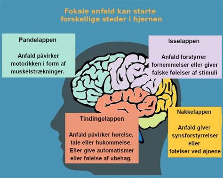 Fokal Epilepsi Ekonomisk information