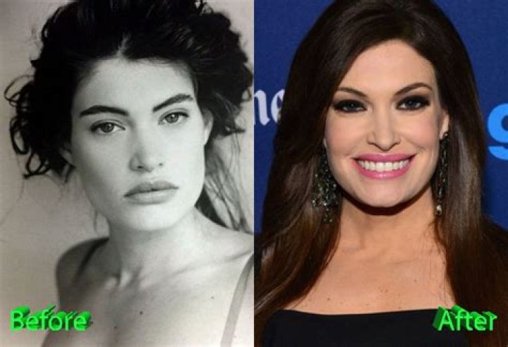 Kimberly Guilfoyle Plastic Surgery A New Youth For News Anchor
