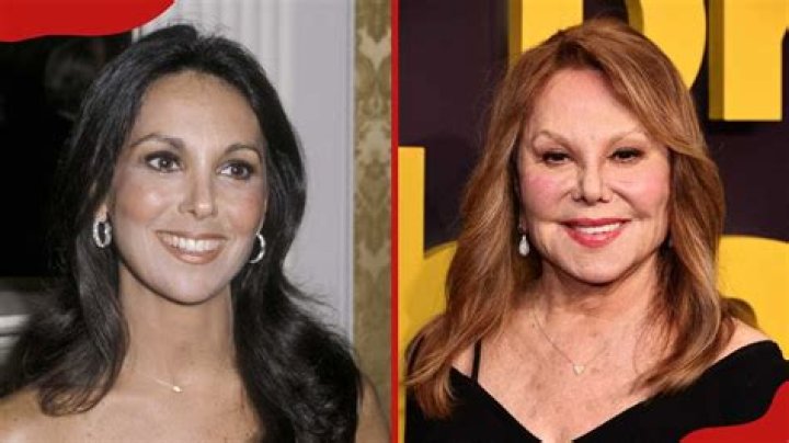 Marlo Thomas Plastic Surgery Before and After Facelift Plastic Surgery