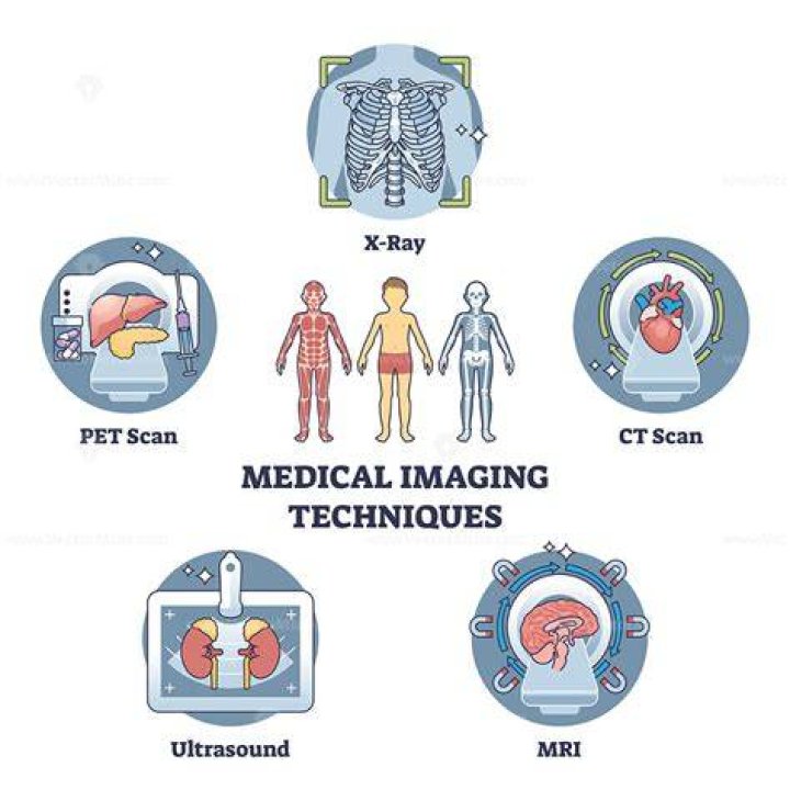 New imaging technique to identify and treat the blood clots