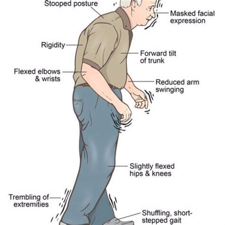 parkinson's disease may be stopped