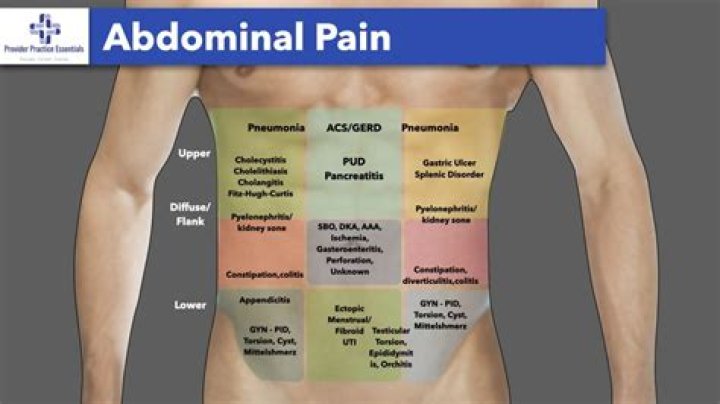 Performing a Thorough Abdominal Exam A Step by Step Guide