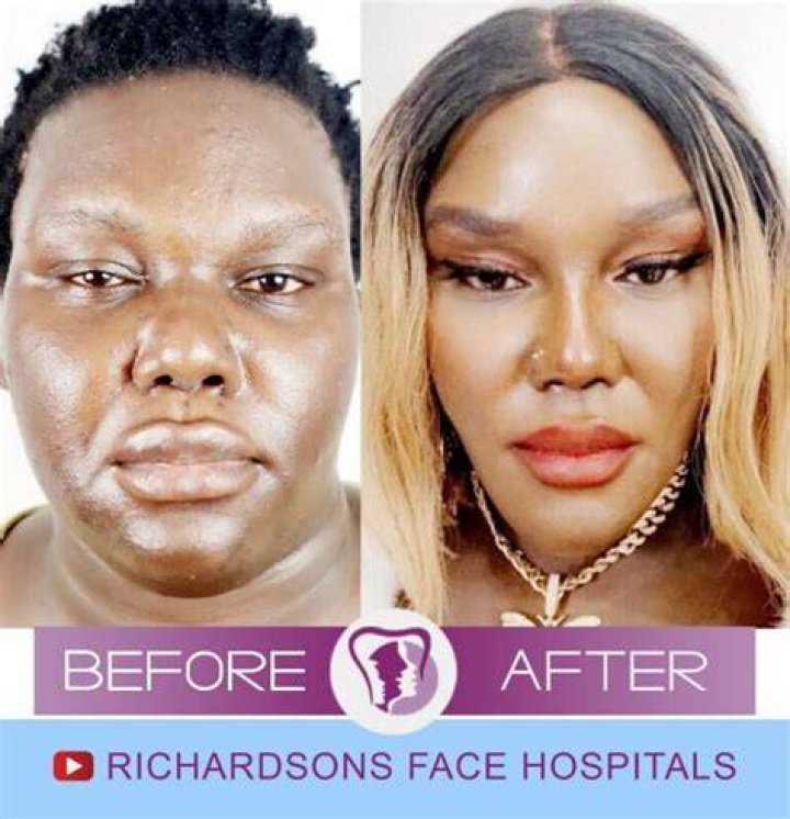 Plastic Surgery