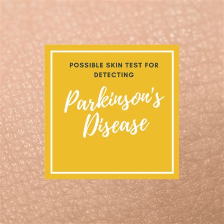 Possible Skin Test for Detecting Parkinson's Disease Premier