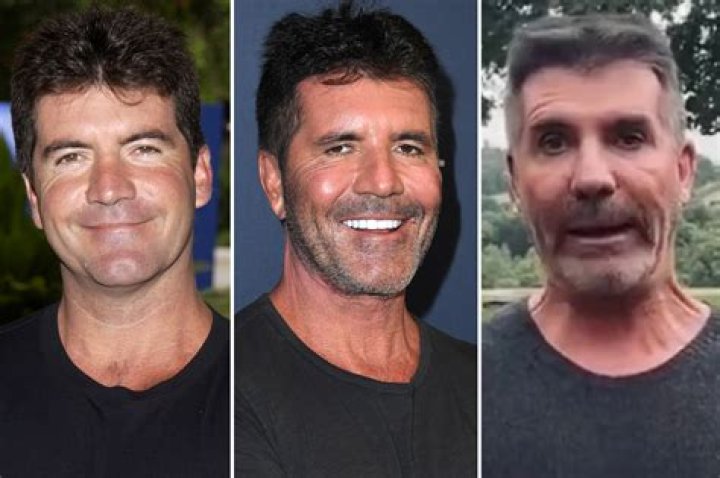 Simon Cowell face explained from surgery rumours to vegan diet