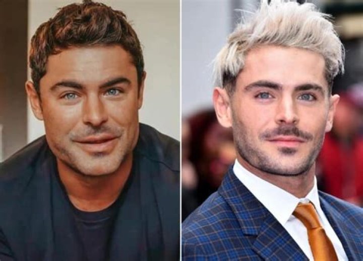 Zac Efron Plastic Surgery With Before And After Photos