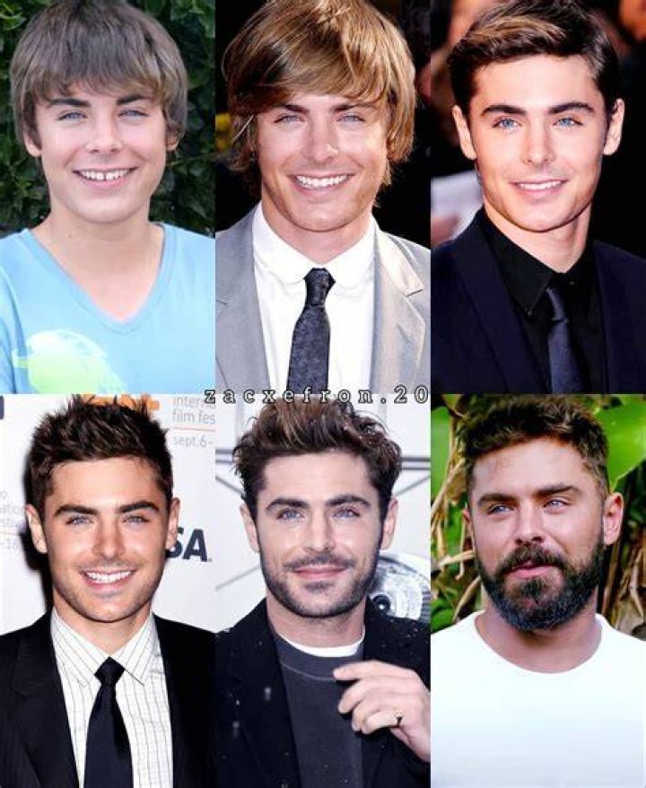 Zac Efron through the years His career evolution in photos Monkey Viral